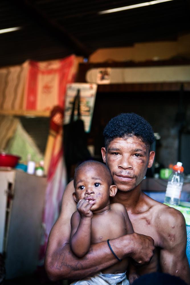 De afdronk smaakt naar armoede